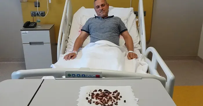 Doktorları şaşkına çeviren vaka: Adamın böbreğinden 100 e yakın taş çıktı: Sağ böbreğin tamamı taşla doluydu