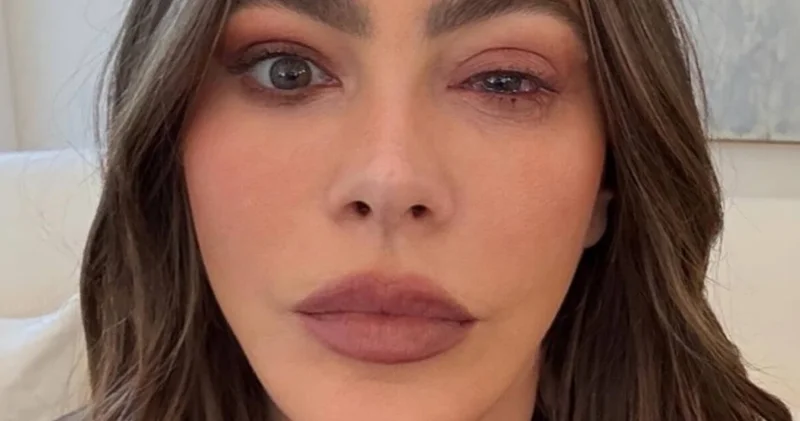 Sofia Vergara Emmy töreni yerine acil servise gitti magazin haberleri