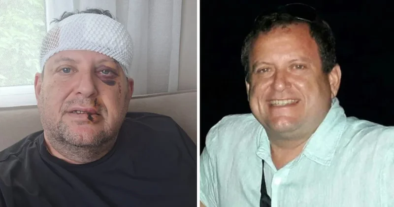Muğla da gazeteciyi darbeden 2 şüpheli salıverildi Sözcü Gazetesi
