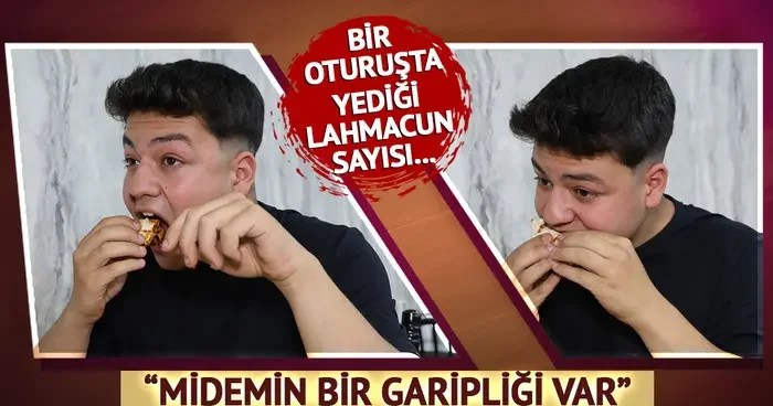 İştahı hiç bitmiyor, hatta yedikçe daha da acıkıyor! Midemin bir garipliği var