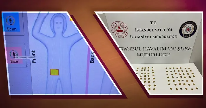 Yer: İstanbul Havalimanı! X ray, kadınların cinsel organlarında yoğunluk tespit etti... Gerçek şaşkına çeviriyor!