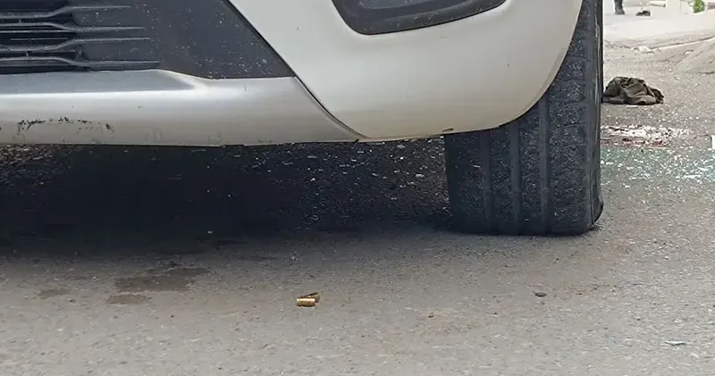 İş dönüşü evinin önünde uğradığı silahlı saldırıda yaralandı