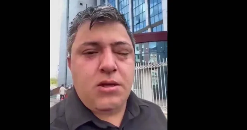 AKP li belediye yöneticileri işçi darp etti iddiası Sözcü Gazetesi