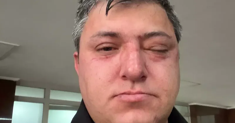 Vahim iddia: Altındağ Belediye Başkanı Tiryaki belediye işçisini darp etti
