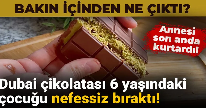 Dubai çikolatası 6 yaşındaki çocuğu nefessiz bıraktı! Bakın içinden ne çıktı