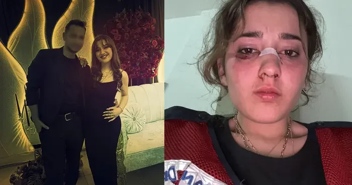 Nişanlı çiftin tatili kabusa döndü! Plajda kafa atıp, motosiklet kaskıyla dövdü