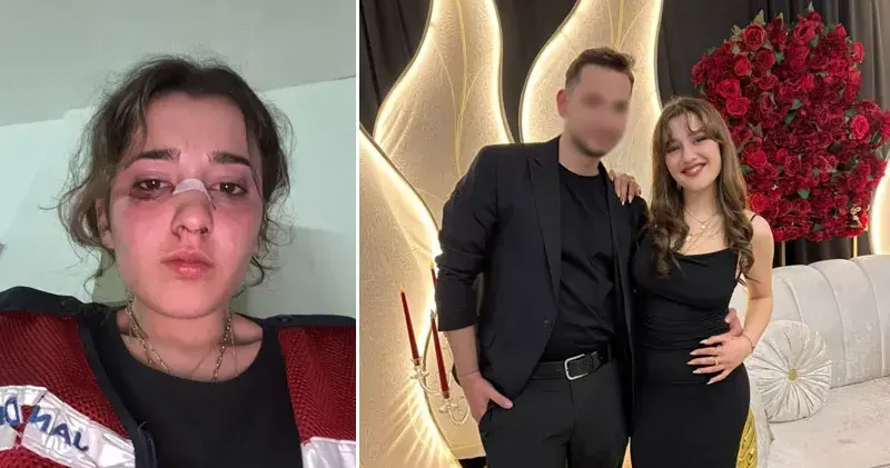 Tatil dönüş planı tartışmasında nişanlısını plajda motosiklet kaskıyla dövdü