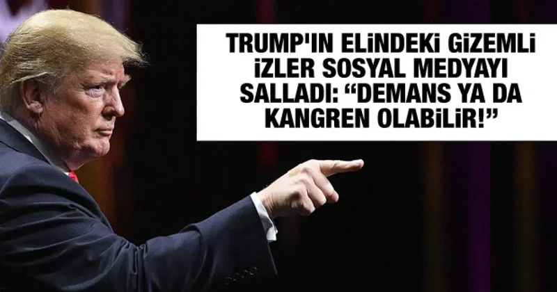 Trump ın elindeki gizemli izler sosyal medyayı salladı: “Demans ya da kangren olabilir!”