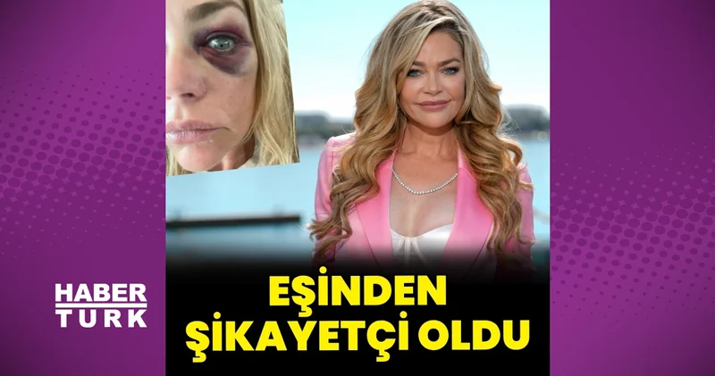 Eşinden şiddet gören ünlü oyuncu Denise Richards uzaklaştırma kararı aldırdı