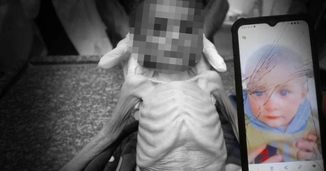 Bir bebek daha açlıktan hayatını kaybetti Ortadoğu Haberleri