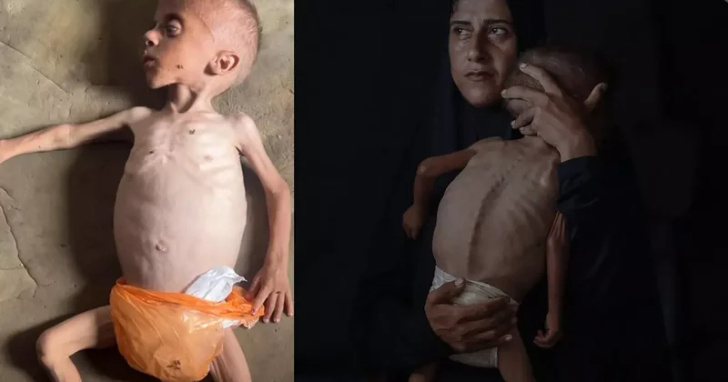 İsrail in açlık silahı... Gazze de 40 binden fazla bebek ölüm riskiyle karşı karşıya