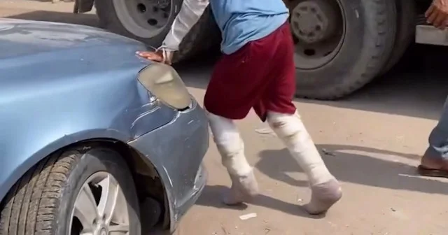 Gazzeli çocuk ağır yaralarıyla yaşam mücadelesi veriyor VİDEO İZLE