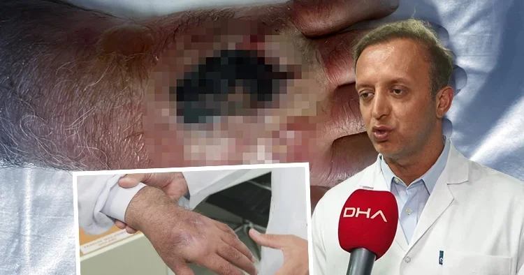 İnsan ısırığının şiddetini gördük İstanbul da doktorları bile şaşkına çeviren olay: Literatüre girecek