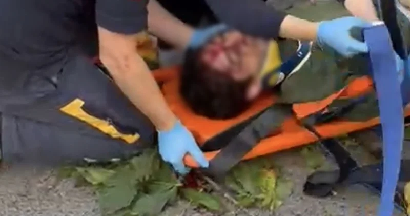 Ünlü oyuncu İbrahim Yıldız ın üzerine ağaç düştü! Korkunç olay kameraya böyle yansıdı