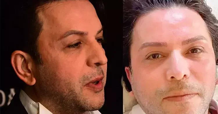 Ayrılık sürecinde döküldü...Sadece kaş yaptırdım