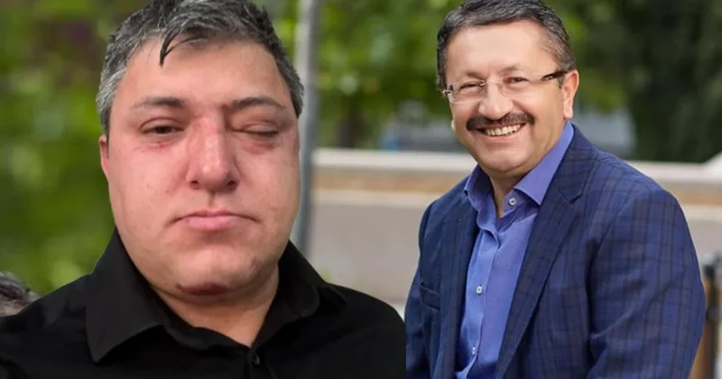 Akılalmaz iddia... Buraya kadar geldik mi? Belediye başkanı ve yardımcıları işçi dövdü Sözcü Gazetesi