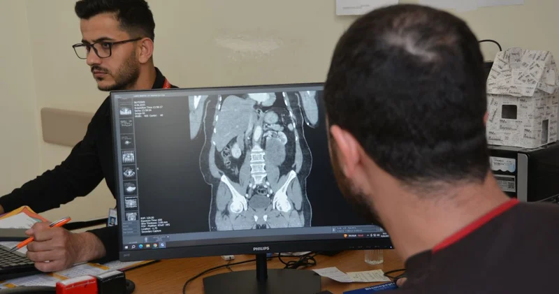 Karın şişliği için başvuran hastaya 23 santimlik şok