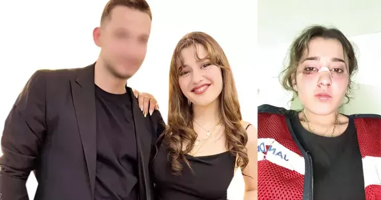Nişanlı dehşeti... Yüzüne kafa attı kaskıyla darp etti
