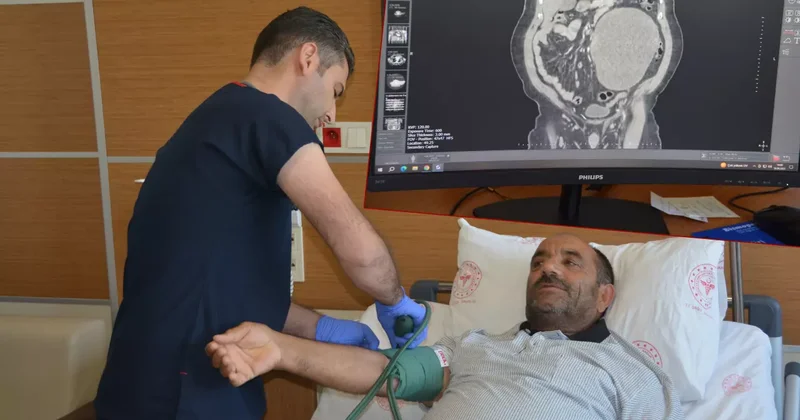 Karın ağrısı şikayetiyle gitti, doktorlar bile şoke oldu! Tam 23 santim...