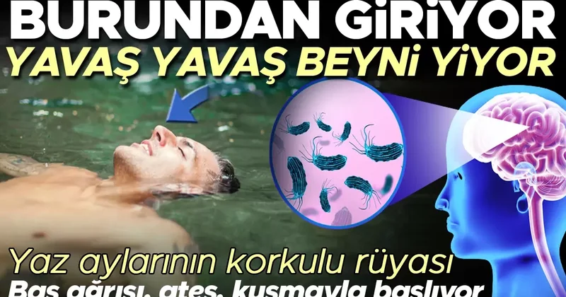 Yaz aylarının korkulu rüyası Beyin yiyen amip Tatlı sulardan bulaşıyor, burundan giriyor, ölüme kadar gidiyor