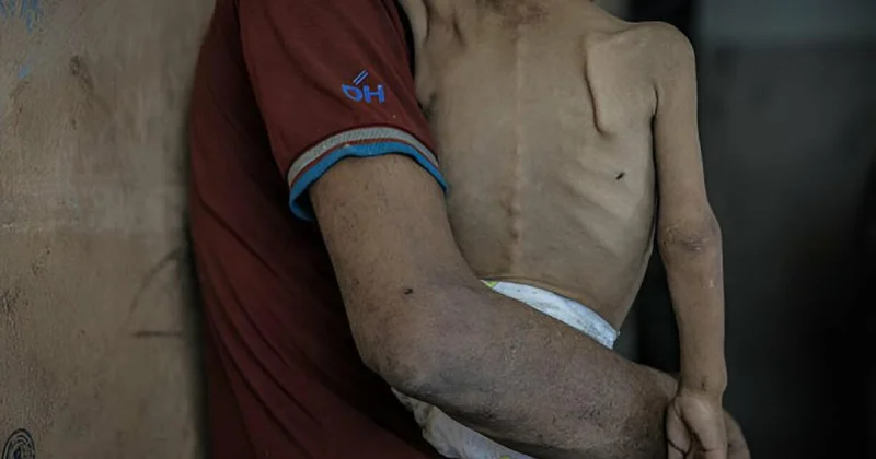 İsrail in insani yardım girişini kısıtladığı Gazze de bir çocuk daha açlıktan hayatını kaybetti