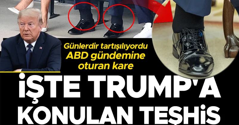 Günlerdir tartışılıyordu: ABD nin gündemine oturan kare! İşte Trump a konulan teşhis