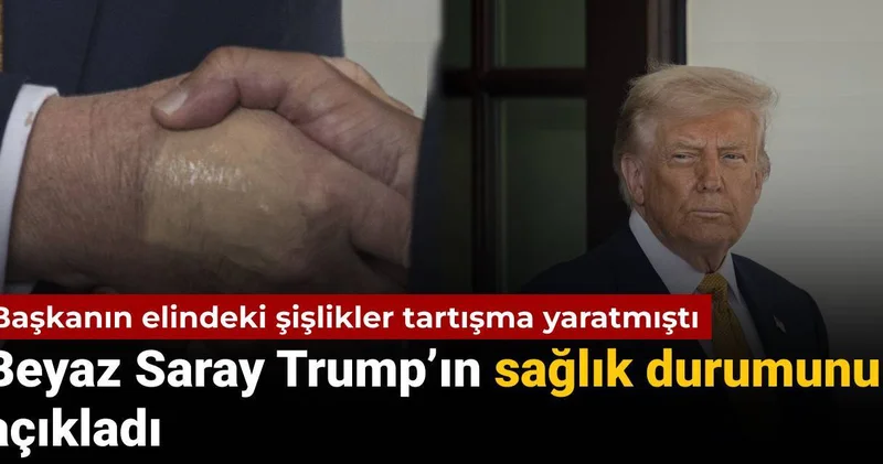 79 yaşındaki başkanın elindeki doku hasarı tartışma yaratmıştı: Beyaz Saray Trump ın sağlık durumunu açıkladı