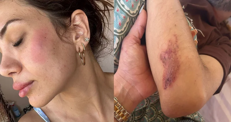 Vahşetin böylesi: Evinin önündeki köpekleri besleyen veteriner darp edildi