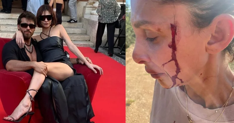 Can Yaman ın sevgilisi kanlar içinde paylaşım yaptı: Şiddet görüyorum Sözcü Gazetesi