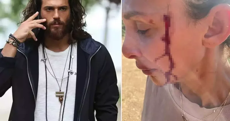 Can Yaman ın sevgilisi Sara Bluma şiddet gördüğünü açıkladı