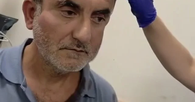 Ekoloji grubu sözcüsüne beton santralinin ortağından darp iddiası Hatay Haberleri