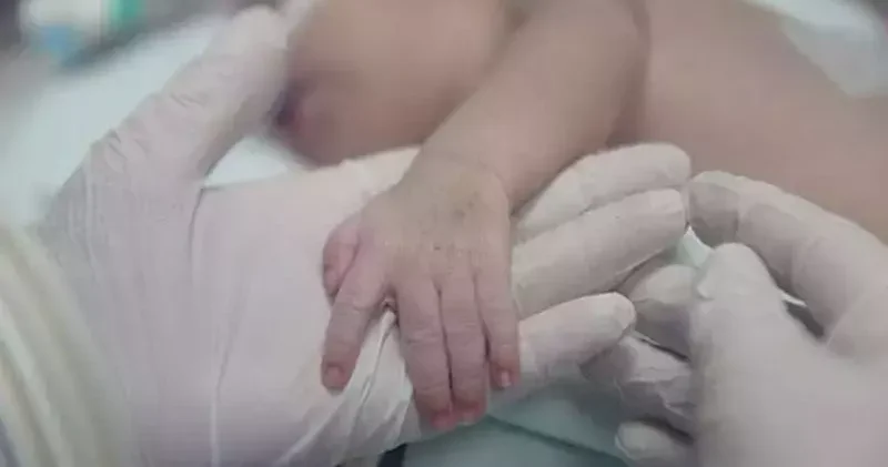 Geçen yıl 31 bin 109 anne, çoğul doğum yaptı