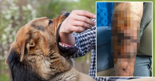 Aksaray da başıboş köpek dehşeti: 76 dikiş atıldı Gündem Haberleri