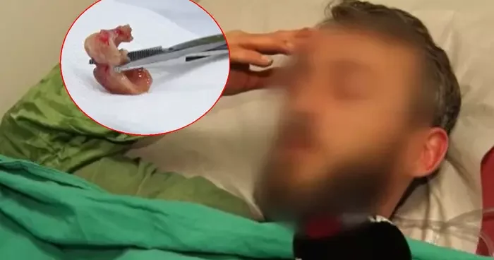 Uykusundan dayanılmaz öksürükle uyandı, aynaya bakınca şok oldu! İlginç olay gece uyurken olmuş