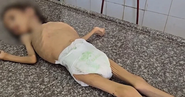 Gazze de yetersiz beslenme nedeniyle 4 yaşındaki Rezan yaşamını yitirdi VİDEO İZLE