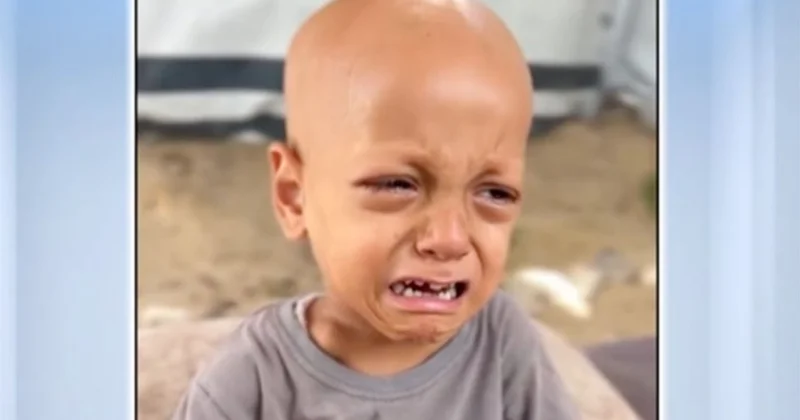 Gazze de açlıktan ölmek üzereyken Türkiye ye getirilen minik Abdullah kurtarılamadı