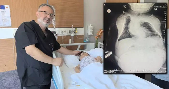24 kiloluk kadının içinden çıktı: 20 santim boyutunda tam 3 kilo! Gaz sıkışması dedikleri devasa kist çıktı