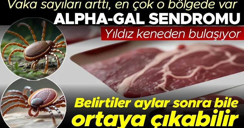 Alpha gal sendromu: Vaka sayıları arttı, en çok o bölgede var! Yıldız keneden bulaşıyor, et ve süt ürünlerine karşı alerji gelişiyor