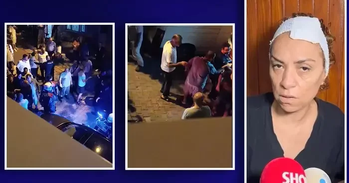 Babanızın yeri mi? tartışması... Talihsiz kadını böyle darp ettiler: Burnum kırık, yemek yiyemiyorum, yürüyemiyorum