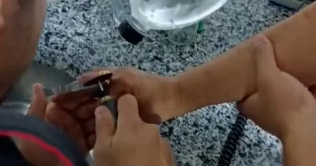 Osmaniye de bir kişinin parmağında sıkışan yüzüğü itfaiye çıkardı VİDEO İZLE