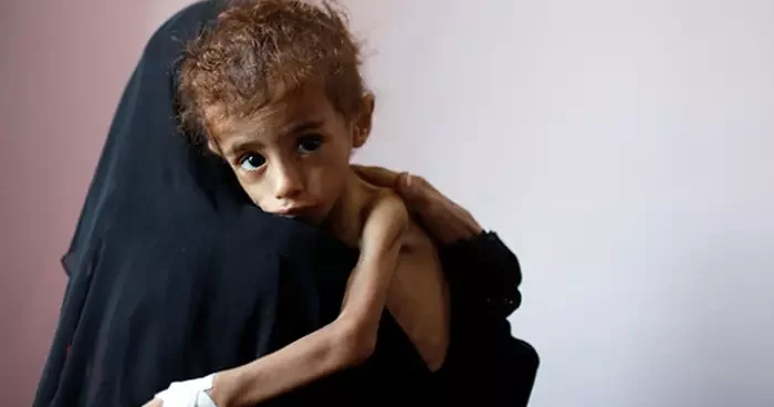 BM ye bağlı 116 kuruluştan, yardım fonlarının yetersiz kaldığı Yemen i kurtarma çağrısı