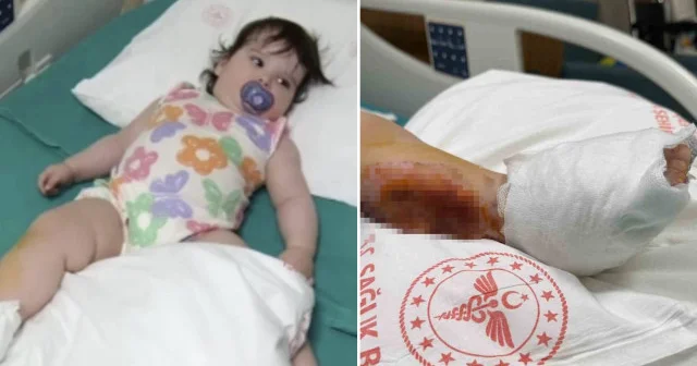 Üzerine çaydanlık devrilen 1 yaşındaki bebek dehşeti yaşadı: Vücudunun yüzde 15 i yandı 3 gün yoğun bakımda kaldı Aktüel Haberleri