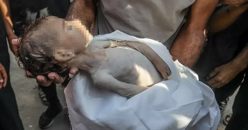 Gazze felaket boyutunda açlıkla karşı karşıya: Çocuklar açlıktan eriyor