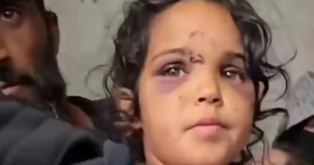 Dürzi isyancılar Süveyda da çocuklara saldırdı: Yüzü gözü moraran küçük Revan yaşadıklarını anlattı VİDEO İZLE