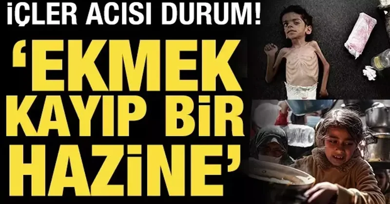 Gazze deki acı gerçek: İnsanlar açlıktan teker teker düşüyor!