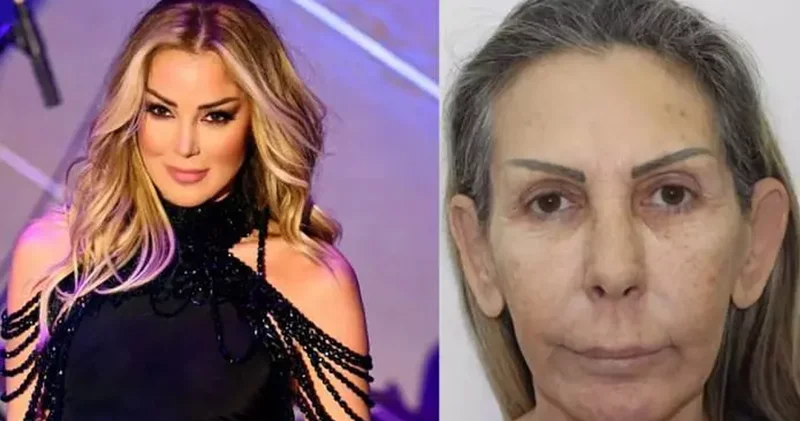 Petek Dinçöz in annesi estetikle tanınmaz hale geldi