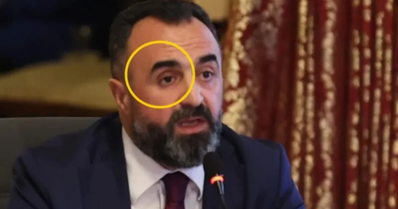 Sağ gözünü eline aldı, vekiller dondu kaldı! Sözcü Gazetesi