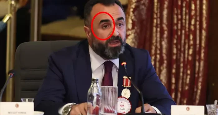 TBMM’deki komisyona damga vuran an! Sağ gözünü çıkarıp öyle anlattı