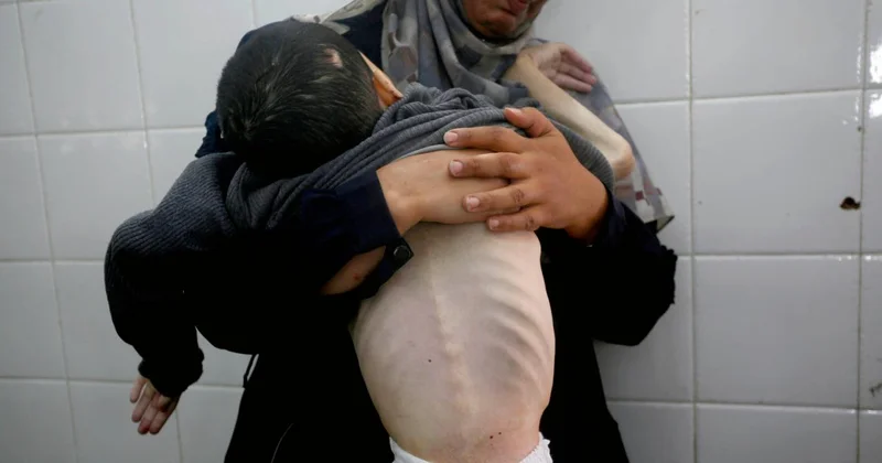 Soykırımcı İsrail in kıtlığı dayattığı Gazze’de 2 Filistinli daha açlıktan hayatını kaybetti