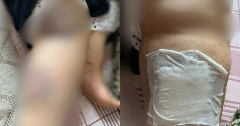 Diyarbakır da dehşet! Eşini kapıyı geç açtığı için darbetti